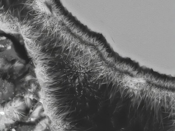 Rasterelektronenmikroskopische Darstellung des Kalksandsteins aus Recyclingmaterial